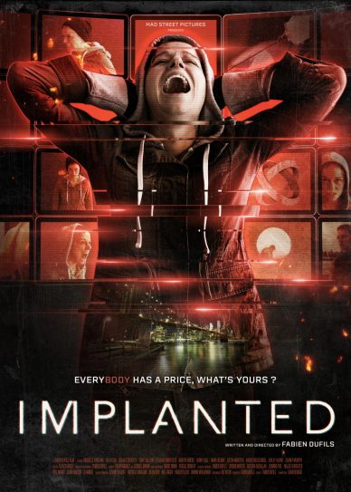 Implanted